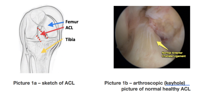 anteriorcruciateligament01